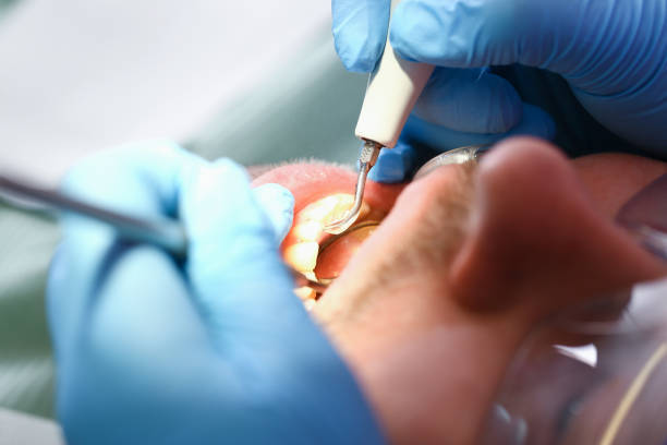 Best Mobile Emergency Dentist in Kensington, CA