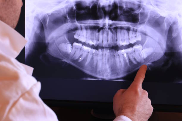 Best Emergency Cosmetic Dentistry in Kensington, CA